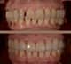 Slider image (10) UltimaDent